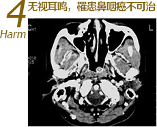 ���Ӷ���������ʰ�������